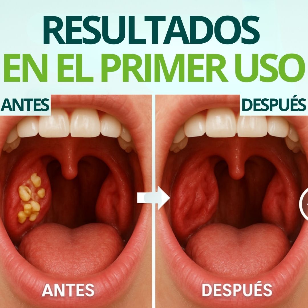 WellFresh™ - Elimina El Mal Aliento